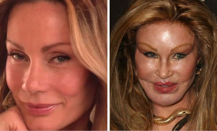 celebrity surgery disasters