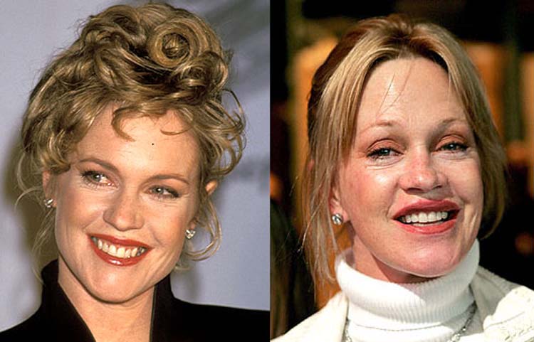 celebrity surgery disasters